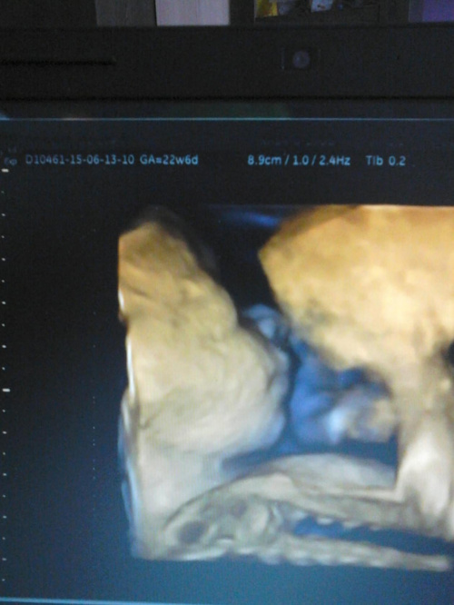 09265b186cc88218med.jpg